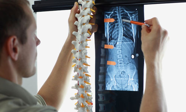 A Brief Overview of Different Scoliosis Treatments