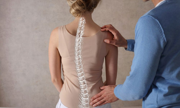 Top 3 Common Myths Surrounding Scoliosis